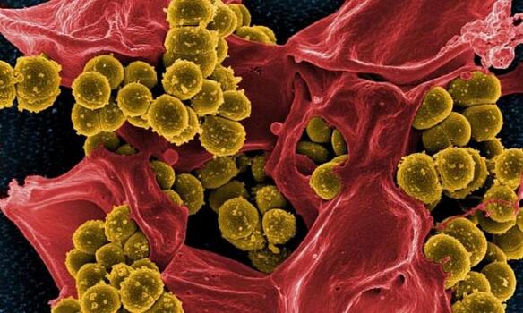 Staphylococcus aureus como causa de prostatite bacteriana